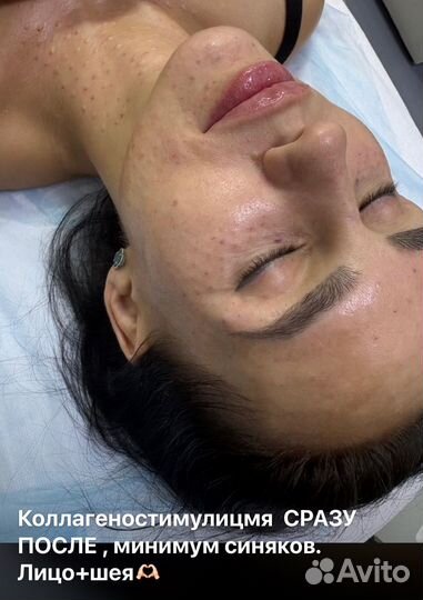 Красивая кожа