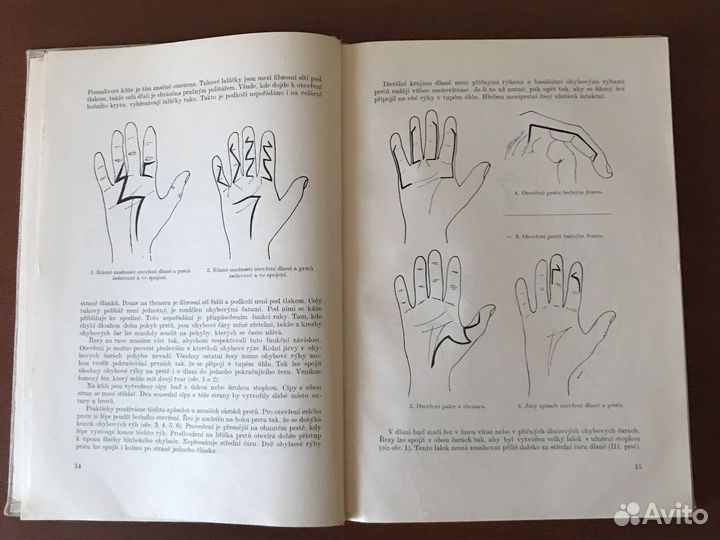 Пластическая хирургия кисти