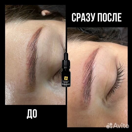 Ремувер для удаления перманента микроблейдинга