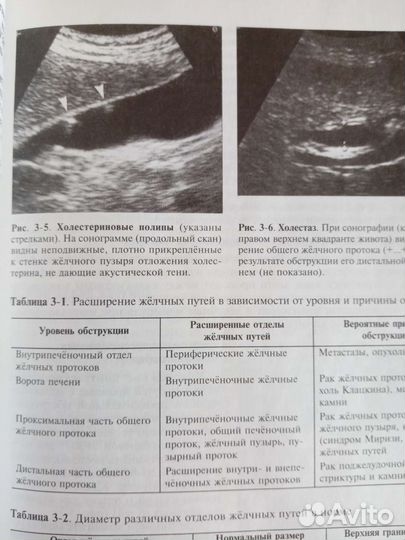 Острый живот