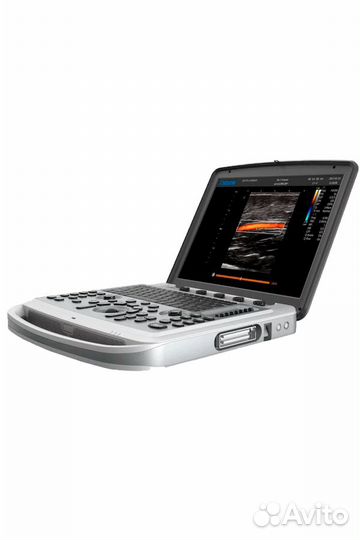Узи-аппарат Chison SonoBook 6