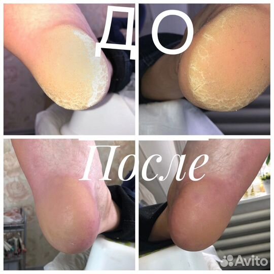 Маникюр, педикюр, наращивание ногтей