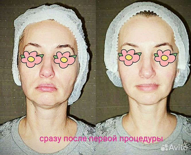 Массаж лица, массаж тела