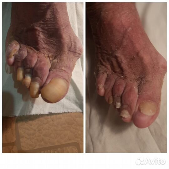 Подолог. Выезд на дом