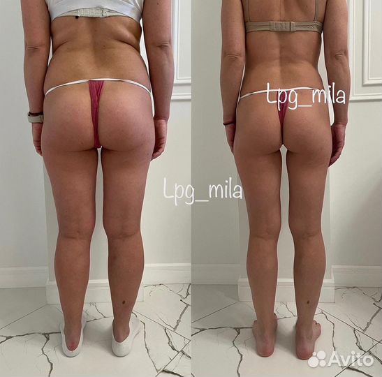 Аппаратный массаж