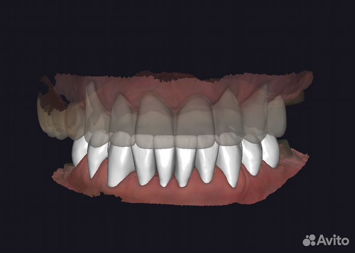 Моделировка в Exocad/Оператор cadcam