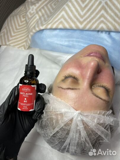 Чистка лица/пилинг/уход