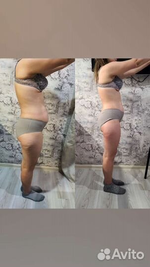 Аппаратная коррекция фигуры: вакуумный массаж