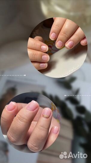 Выравнивание ногтевой пластины