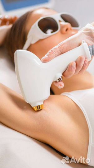 Лазерная эпиляция