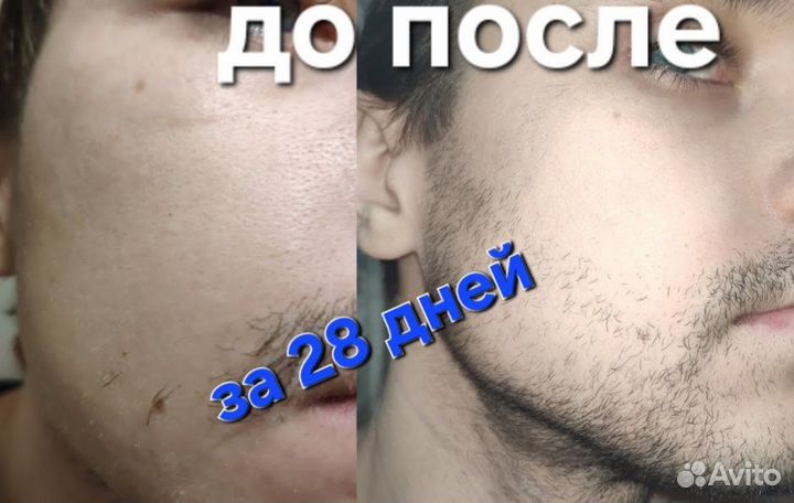 Лосьон для роста волос