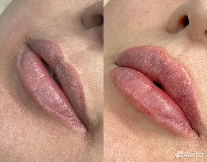 Услуги косметолога