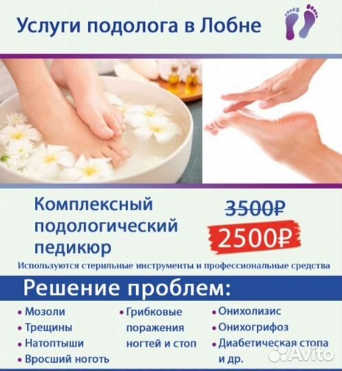 Услуги подолога