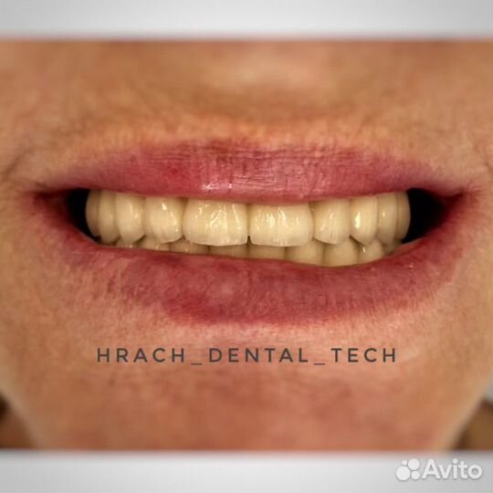 Зубной техник керамист сотрудничество с врачами