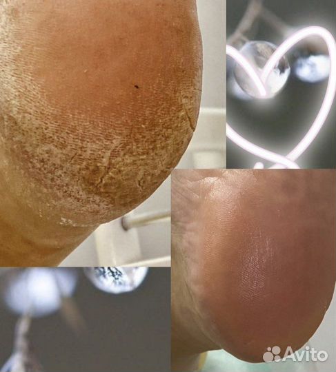 Медицинский и эстетический педикюр и маникюр