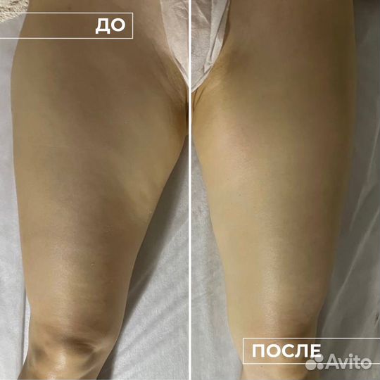 Модель на аппаратный массаж тела для похудения