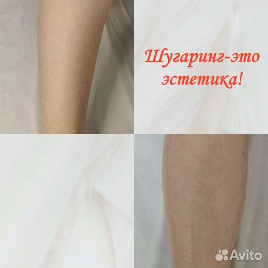 Депиляция, шугаринг, ваксинг
