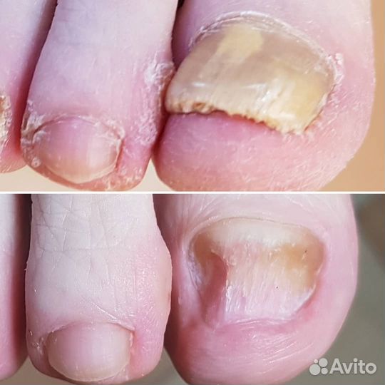 Педикюр. Подология. Ортониксия