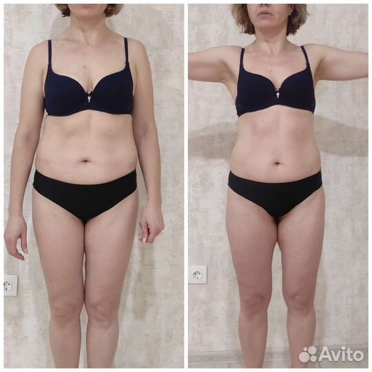 Антицеллюлитный и коррекция фигуры массаж