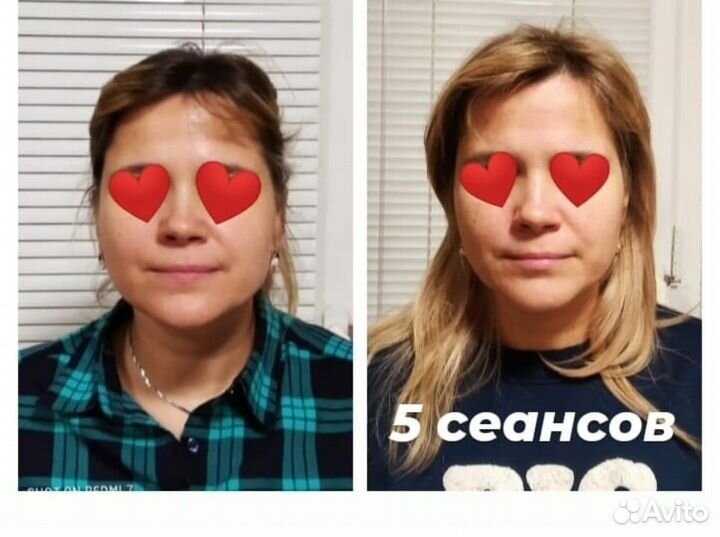 Омолаживающий массаж лица. Коррекция осанки,массаж