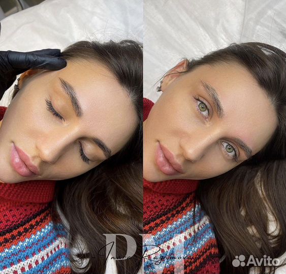 Лазерное удаление татуировок и татуажа