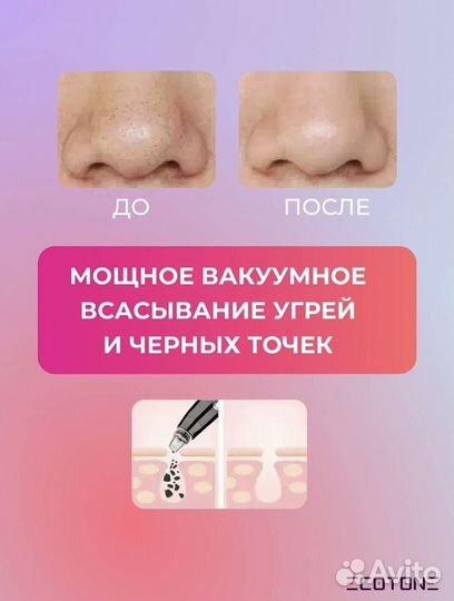 Вакуумный инструмент для очищения кожи новый