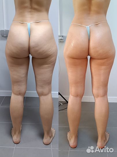 Массаж + кедровая бочка сауна. Супер эффект