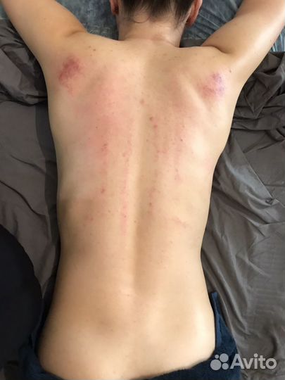 Массаж на дому