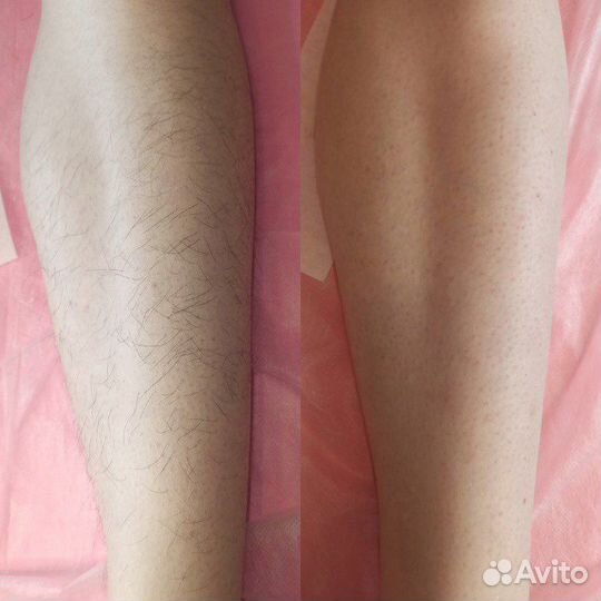 Массаж. Шугаринг