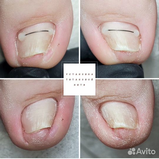 Услуги подолога