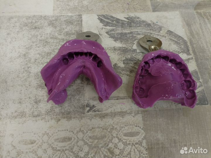 Съёмный зубной протез