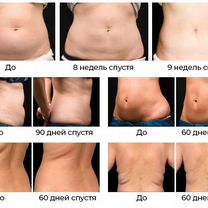 Коррекция фигуры, похудение, Севастополь