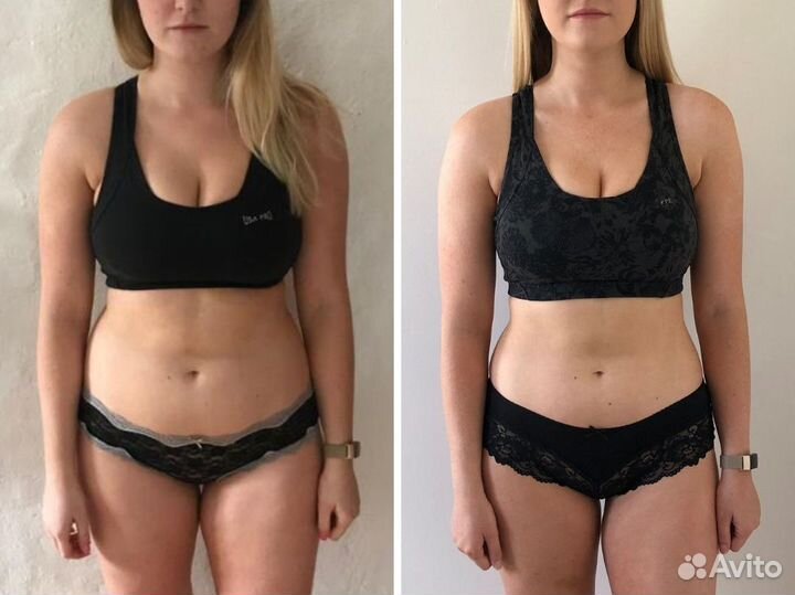 EMS стимуляция в Славянке