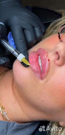 Услуги косметолога