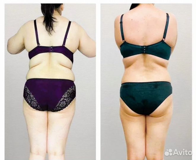 Плоский живот