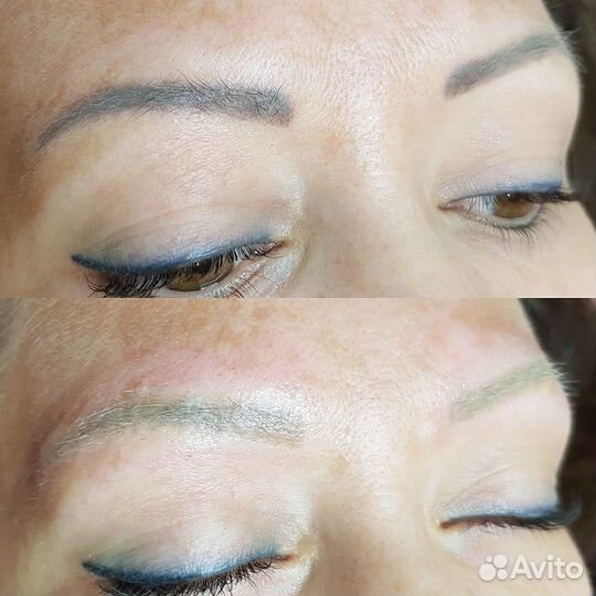 Удаление тату и татуажа