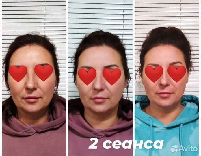 Омолаживающий массаж лица. Коррекция осанки,массаж