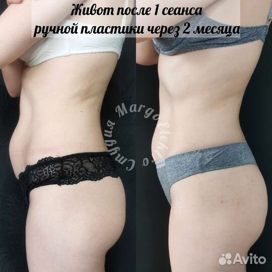 Ручная пластика тела, коррекция фигуры