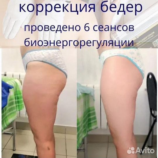 Биоэнергорегуляция серебряными перчатками