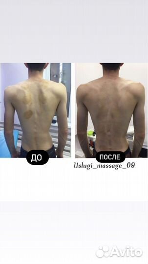 Услуги массажа