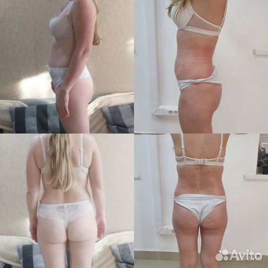 Массаж коррекция фигуры. Похудение