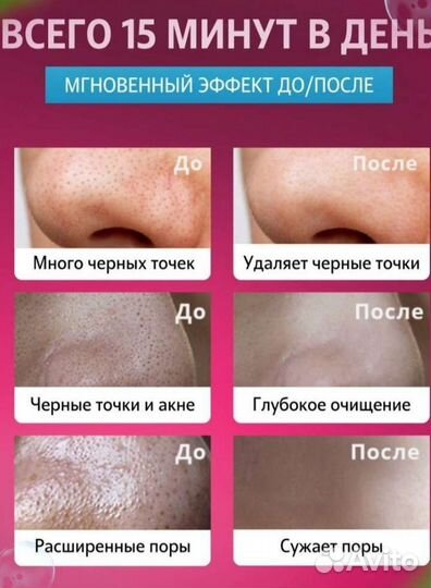 Маска от прыщей и черных точек