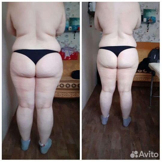 Антицеллюлитный массаж, классический, массаж лица