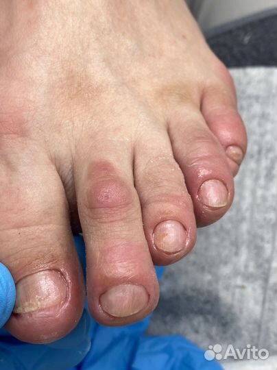 Услуги подолога