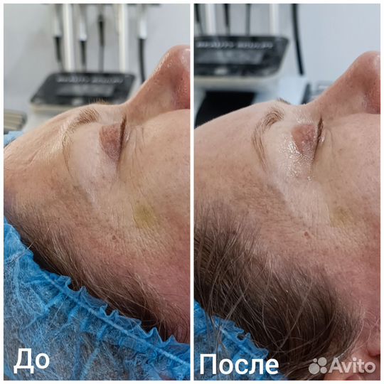 Массаж лица