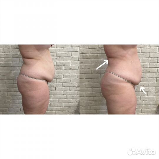 Массаж всего тела