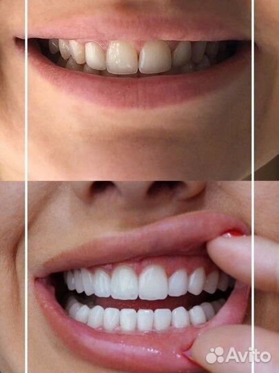 Сертификат на зубы