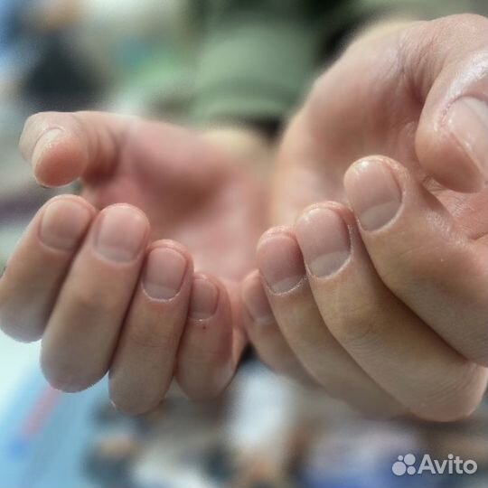 Подолг в Солнцево. Проблемные ногти и пятки