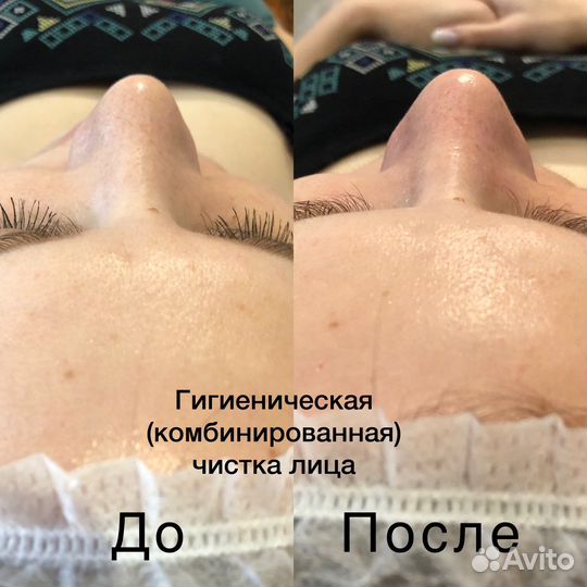 Услуги косметолога