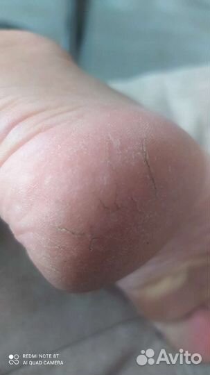 Педикюр, маникюр на дому